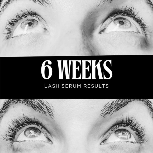 Eyelash Growth Serum Results - Picture 7 of 8